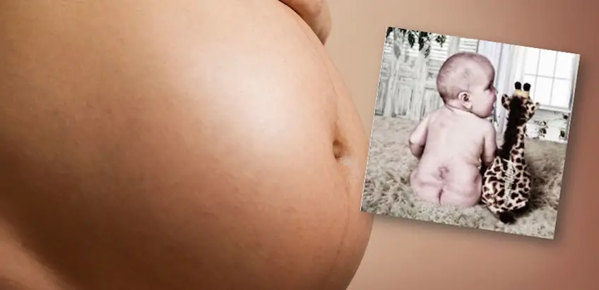 Bauch baby bilder offener Macht Mut:
