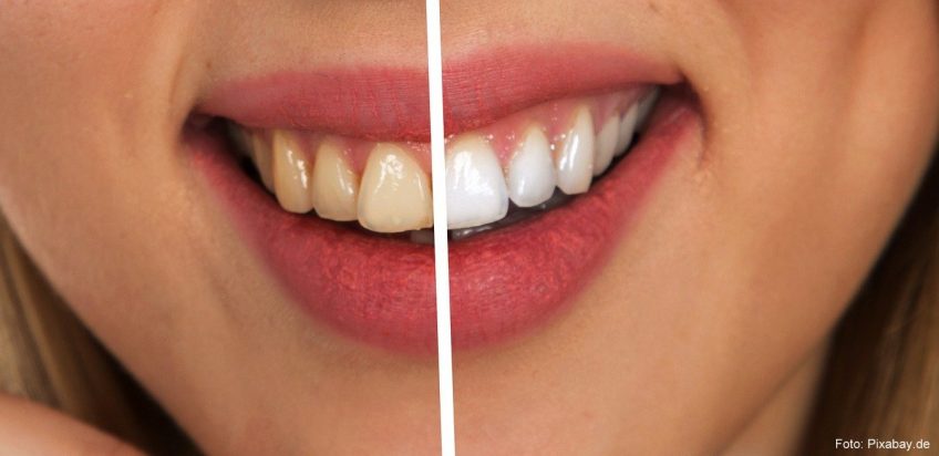 Zähneputzen ist nicht schwer? – Warum die Pflege unserer Zähne immens wichtig ist